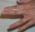 Buddy-tape (kilde: www.aafp.org)
