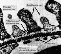 EM-bilde av glomerulusmembranen i nyre (Foto: www.tidsskriftet.no)