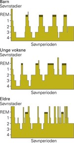 S�vnstadier i ulike aldre (Kilde: www.tidsskriftet.no)
