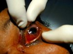 �yeskade fra NCEMI Case of the Week (Foto: www.ncemi.org)