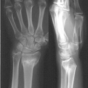 Bilde fra trauma imagebank